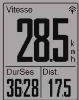 Bryton Rider 330 - REMARQUE : - 2