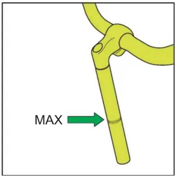 Sparta Amphion - Lenker - 1