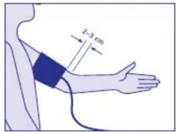 Visomat Comfort II - Colocacion del manguito - 1