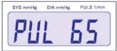 Visomat Comfort II - Bref descriptif des mesures - 2