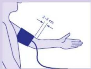 Visomat Comfort II - Fitting the cuff - 1