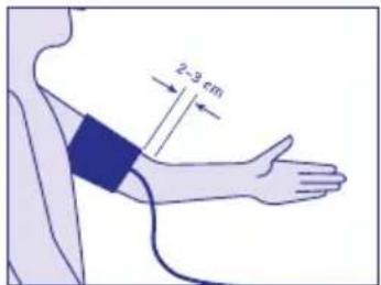 Visomat Comfort II - Application du brassard - 1