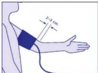 Visomat Comfort II - Fitting the cuff - 1