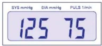 Visomat Comfort II - Bref descriptif des mesures - 1