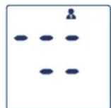 Visomat Comfort Form - Effacement des données - 2