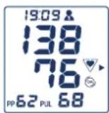 Visomat Comfort Form - Pouls irreguliers et arrhythmies cardiaques - 1