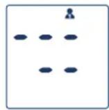 Visomat Comfort 40 - Effacement des données - 2