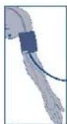 Visomat Comfort 40 - Posizionamento del bracciale - 3