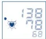 Visomat Comfort 20 - Irregular pulse waves and cardiac arrhythmia - 1