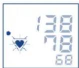 Visomat Comfort 20 - Unregelmäßige Pulswellen und Herzrhythmusstörungen - 1