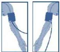 Visomat Comfort 20 - Anlagen der Manschette - 3