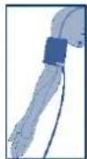 Visomat Comfort 20 - Applicazione del bracciale - 4