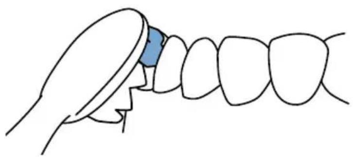 Waterpik Sensonic SR1000 - PpOceccakyctnueckoynCTkn - 1