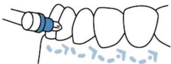 Waterpik Sensonic SR1000 - Uso del cepillo interdental - 1