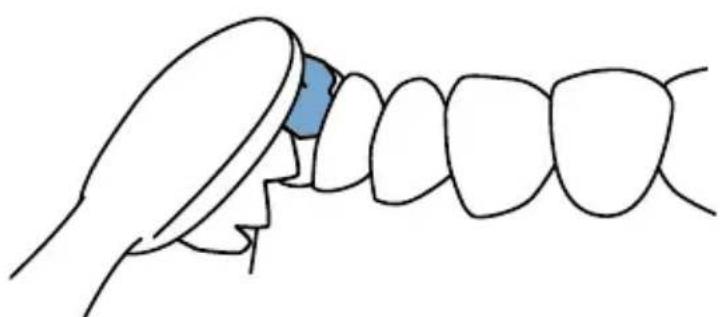 Waterpik Sensonic SR1000 - Testina Sonic - 1