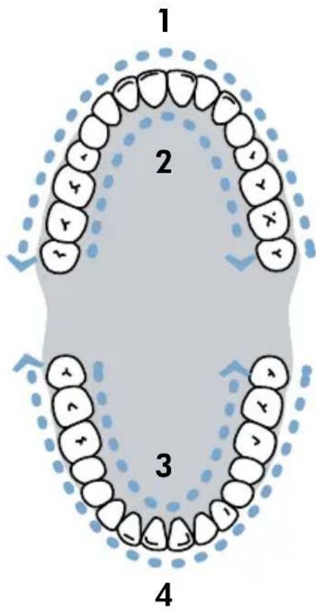 Waterpik Sensonic SR1000 - Sonisch poetsen - 2
