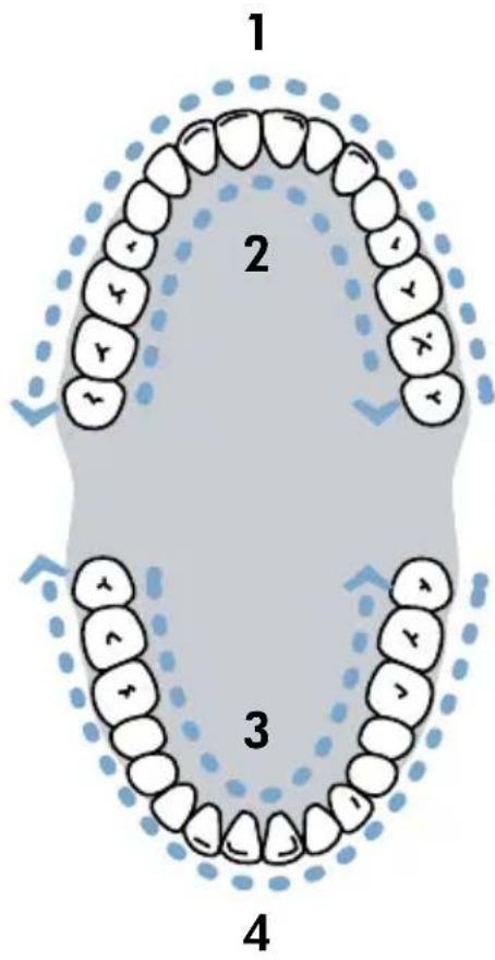 Waterpik Sensonic SR1000 - Schallbürsten - 2