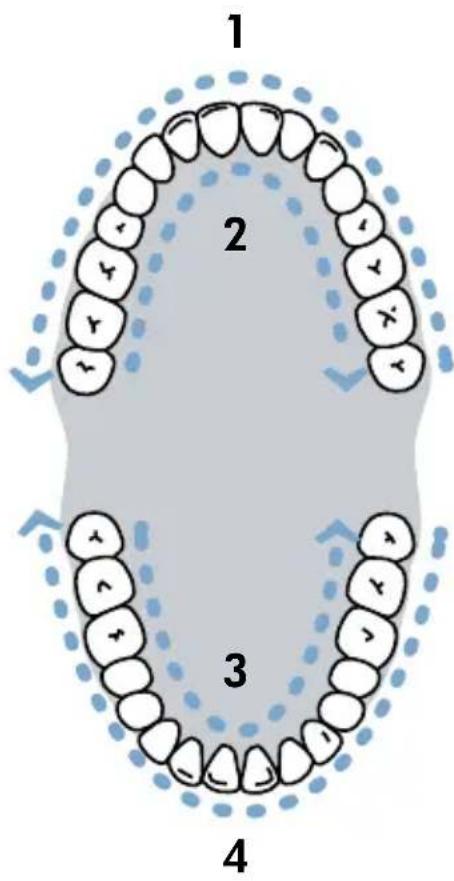 Waterpik Sensonic SR1000 - Testina Sonic - 2