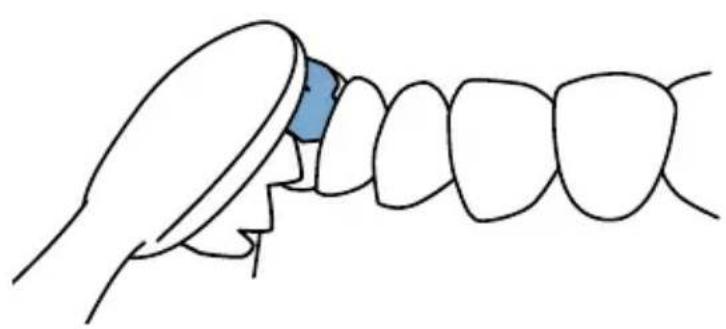 Waterpik Sensonic SR1000 - Brossage ultrasonique - 1