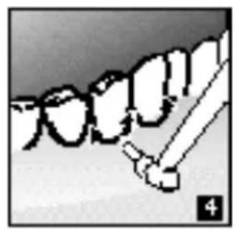 CALOR Dentacontrol Duo Combine 6957 - 5