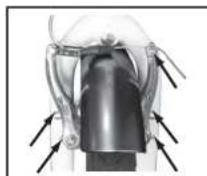 WAYSCRAL Classy 615 - Freni V-brake - 2