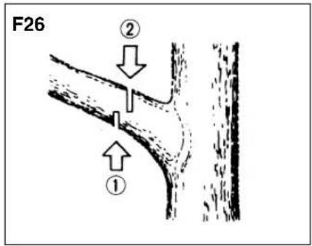 Zenoah G621AVS - Ebranchage d'un arbre abattu (F25) - 1