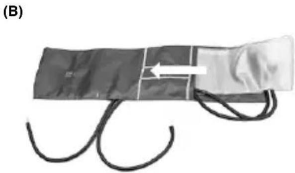 HEINE Gamma G7 - Demontage manchet - 3