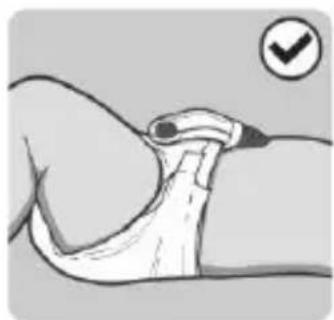 Snuza Hero MD - INSTALLACION DISPOSITIVO HERO MD - 4