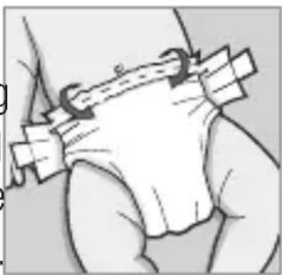 Snuza Go SE - WINDELPASSFORM - 1