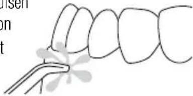 Waterpik WP676 - Massagemodus met hydropulsen - 1