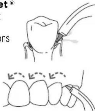 Waterpik WP676 - Utilisation des embouts embout pik pocket - 1