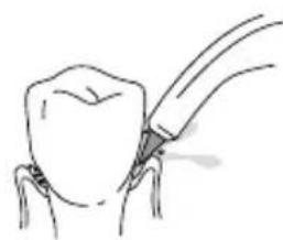 Waterpik WP676 - the unit to the lowest - 1