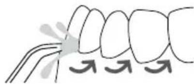 Waterpik WP676 - Astuces techniques pour des résultats optimaux - 1