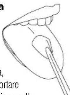 Waterpik WP676 - Beccuccio ortodontico - 1