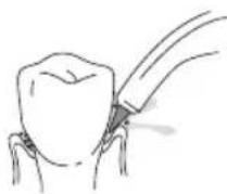 Waterpik WP660 - Pik Pocket Tip - 1