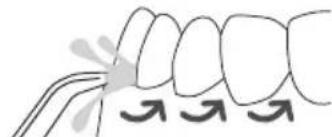 Waterpik WP660 - Techniektips voorBESTe resultaten - 1