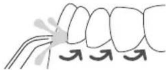 Waterpik WP660 - Tipps fur optimale Ergebnisse - 1