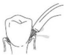 Waterpik WP660 - the unit to the lowest - 1