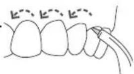 Waterpik WP660 - het apparaat in de laagste drukinstelling - 1