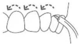 Waterpik WP660 - the unit to the lowest - 2