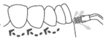 Waterpik WP660 - Plaque Seeker® Tip - 1