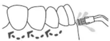 Waterpik WP660 - Embout brosse à dents - 2