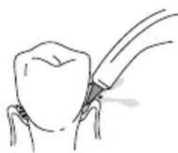 Waterpik WP672 - Pik Pocket® Tip - 1