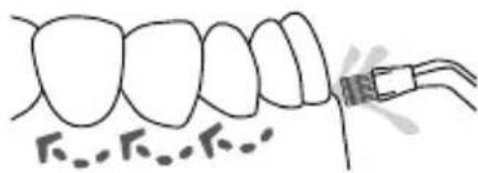 Waterpik WP672 - Plaque Seeker® Tip - 1