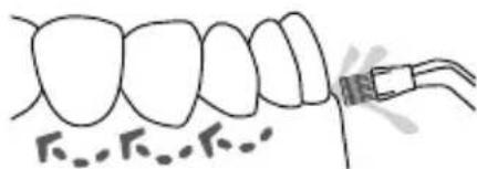 Waterpik WP670 - Plaque Seeker® Tip - 1