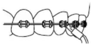 Waterpik WP670 - Beccuccio ortodontico - 1