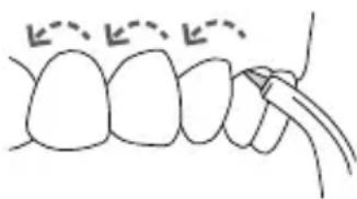 Waterpik WP655 - A fine operazione - 1