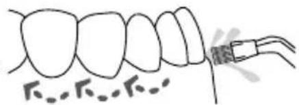 Waterpik WP655 - Plaque Seeker® Tip - 1