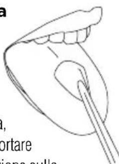 Waterpik WP650 - Beccuccio ortodontico - 1