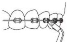 Waterpik WF03 - Tandenborsteltip - 2